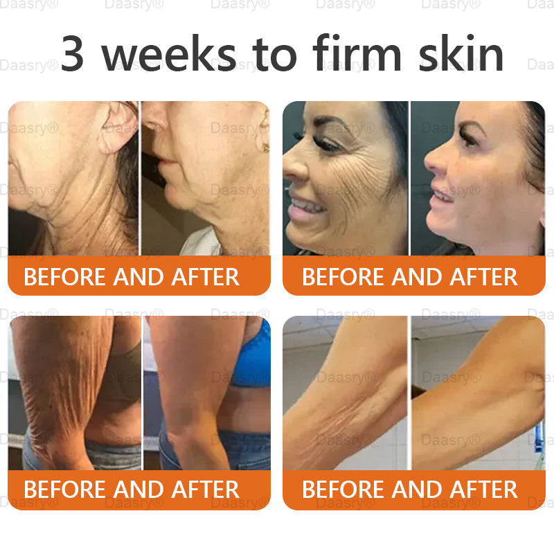 👨⚕️Tienda de Mayo Clinic y Cleveland Clinic: Hecho y enviado desde EE. UU. -✨ Natravor™ "Dermal Gold" Crema restauradora de la piel con veneno de abeja y botox - 🔥ÚLTIMO DÍA: 80 % DE DESCUENTO🔥