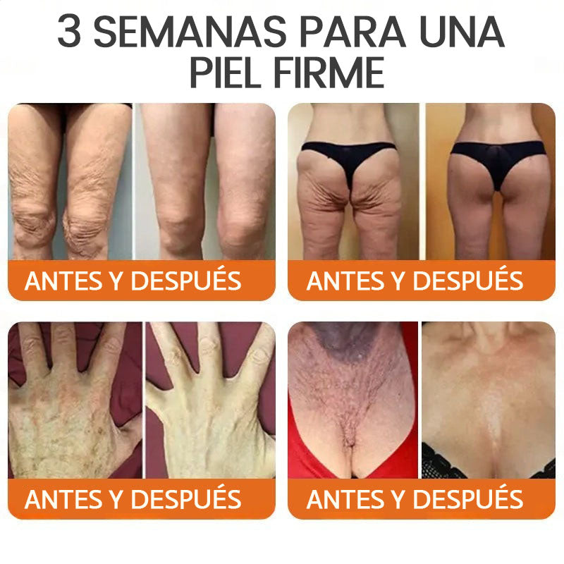 👨⚕️Tienda de Mayo Clinic y Cleveland Clinic: Hecho y enviado desde EE. UU. -✨ Natravor™ "Dermal Gold" Crema restauradora de la piel con veneno de abeja y botox - 🔥ÚLTIMO DÍA: 80 % DE DESCUENTO🔥