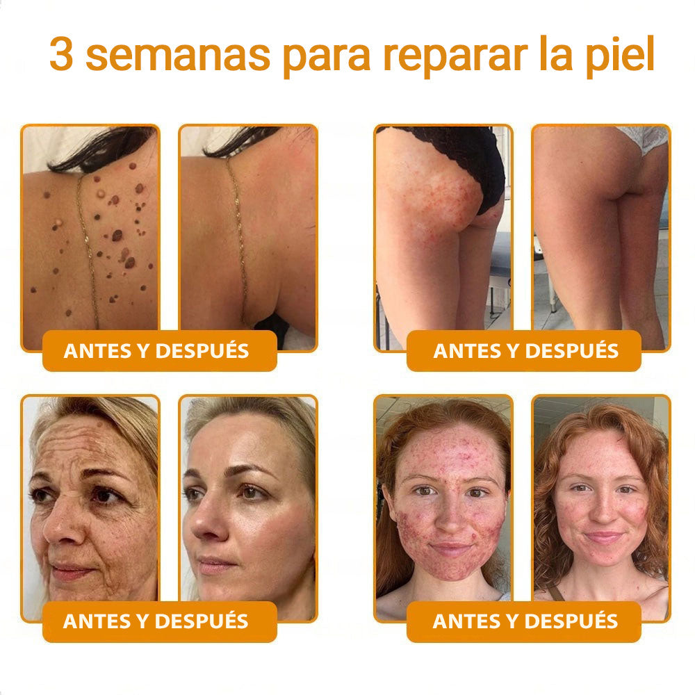 👨⚕️Tienda de Mayo Clinic y Cleveland Clinic: Hecho y enviado desde EE. UU. -✨ Natravor™ "Dermal Gold" Crema restauradora de la piel con veneno de abeja y botox - 🔥ÚLTIMO DÍA: 80 % DE DESCUENTO🔥