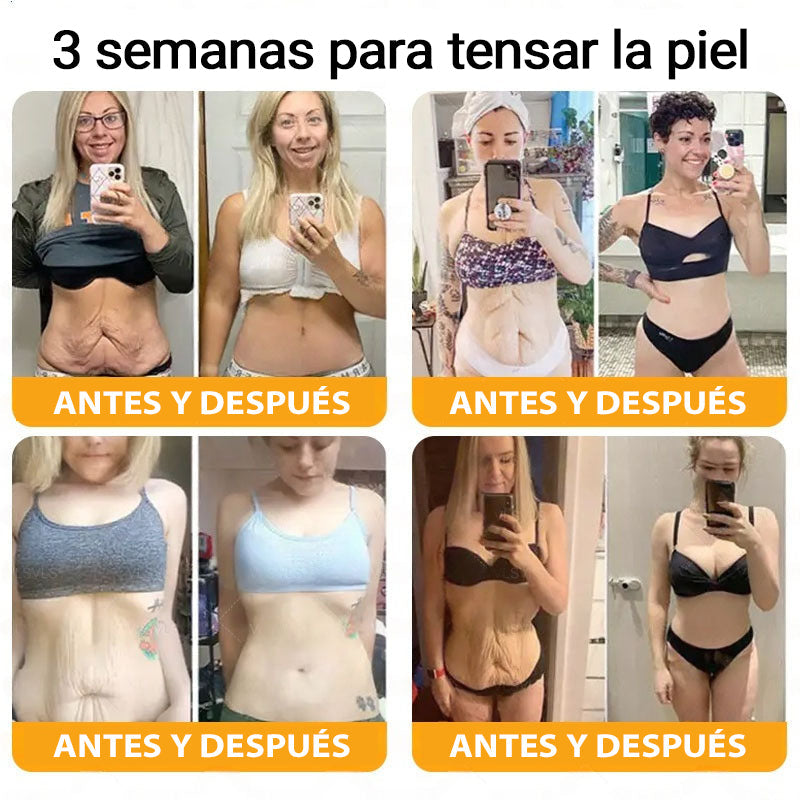 👨⚕️Tienda de Mayo Clinic y Cleveland Clinic: Hecho y enviado desde EE. UU. -✨ Natravor™ "Dermal Gold" Crema restauradora de la piel con veneno de abeja y botox - 🔥ÚLTIMO DÍA: 80 % DE DESCUENTO🔥