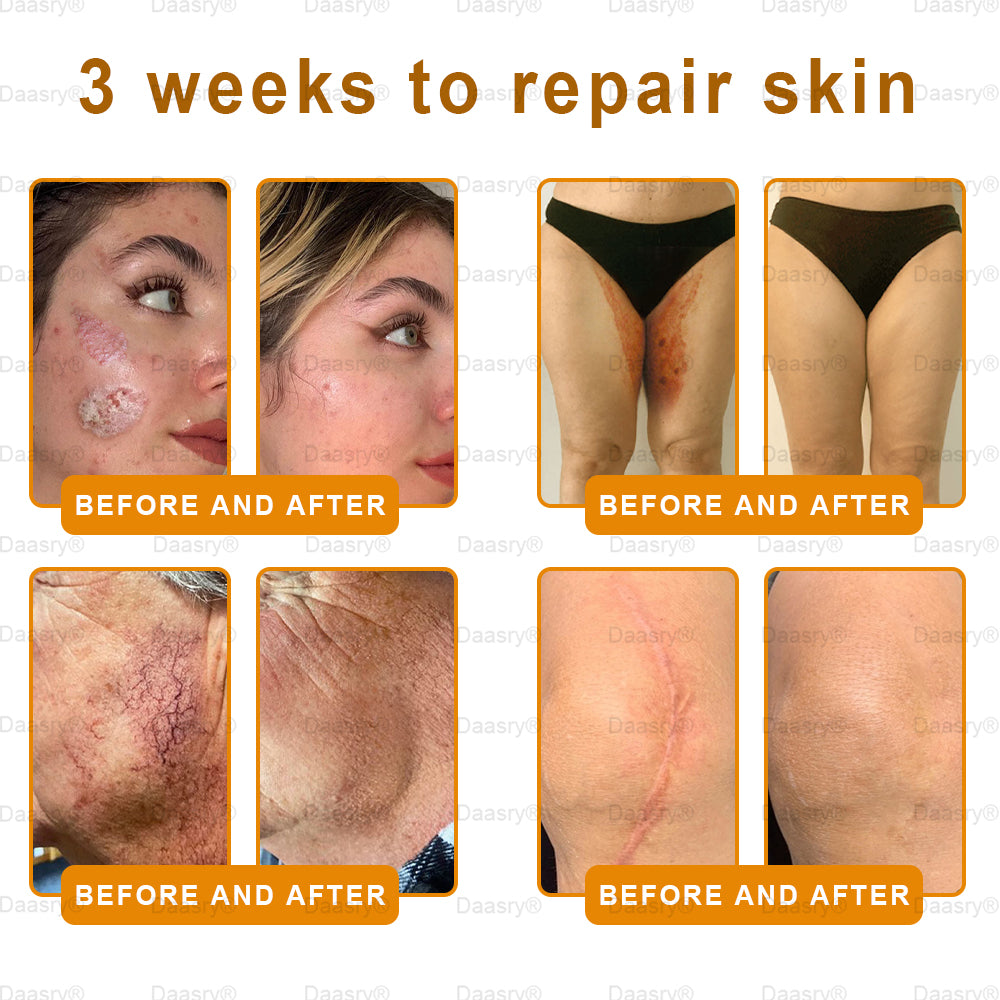 👨⚕️Tienda de Mayo Clinic y Cleveland Clinic: Hecho y enviado desde EE. UU. -✨ Natravor™ "Dermal Gold" Crema restauradora de la piel con veneno de abeja y botox - 🔥ÚLTIMO DÍA: 80 % DE DESCUENTO🔥