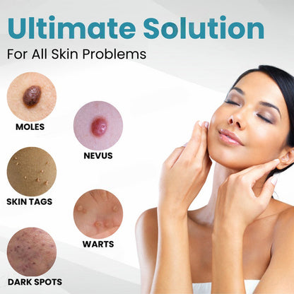 Natravor™ Non-Invasive Mole and Wart Removal Laser Pen