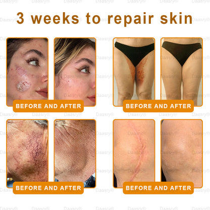 👨‍⚕️Tienda de Mayo Clinic y Cleveland Clinic: Hecho y enviado desde EE. UU. -✨ Natravor™ "Dermal Gold" Crema restauradora de la piel con veneno de abeja y botox - 🔥ÚLTIMO DÍA: 80 % DE DESCUENTO🔥