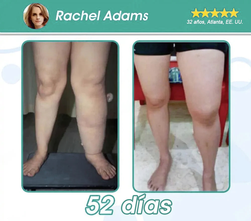 [Tienda oficial] Natravor® GLP-1 Slimming Essence Pearls 🍏｜Triple acción: NAD⁺, moringa y vinagre de manzana｜⚡ Quema rápida de grasa y equilibrio metabólico｜Avalado por expertos en investigación de la obesidad